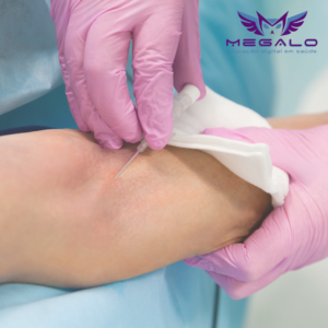 Cuidados com Acesso Venoso Periférico